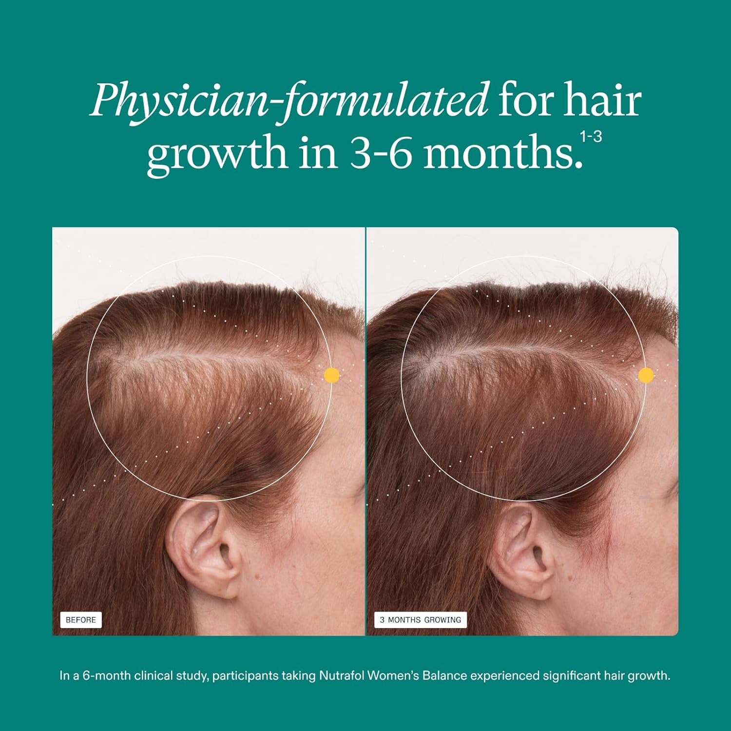 Nutrafol Women's Hair Booster